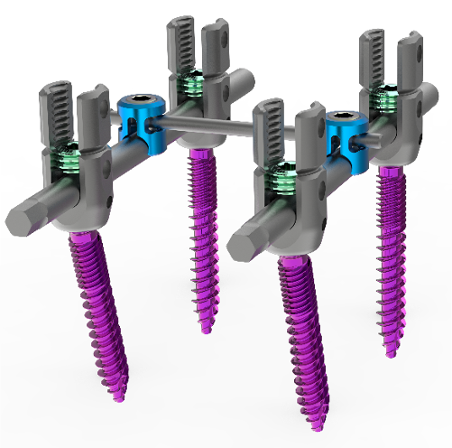 Universal Fixation System for Long Constructsā